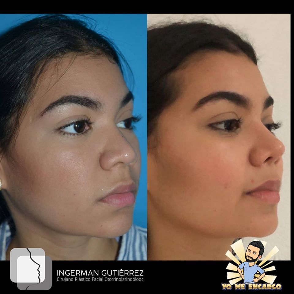 Ingerman Gutiérrez González-4