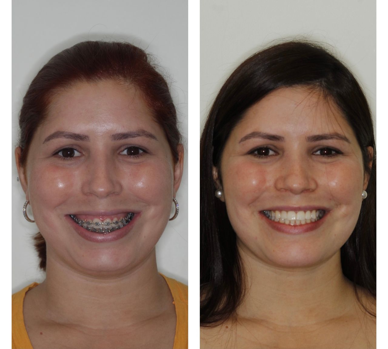 Daniel Assunção-10