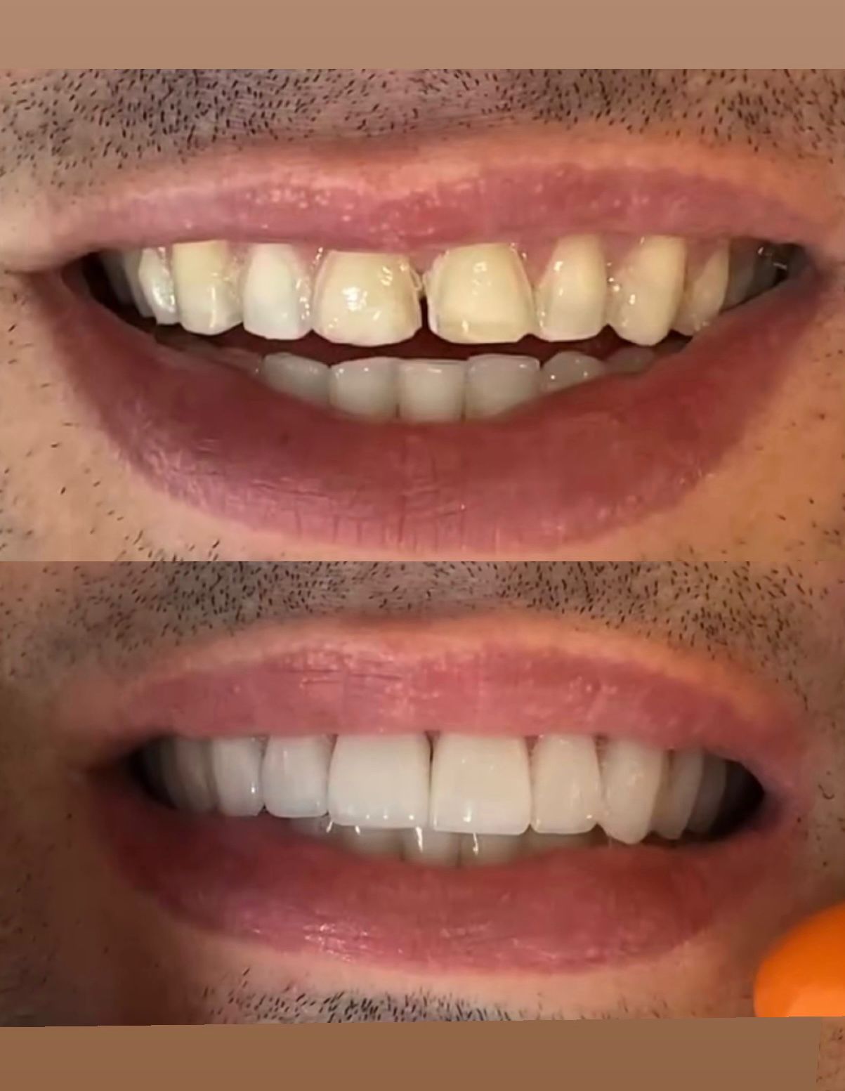 Kellen Dantas Marinho-3