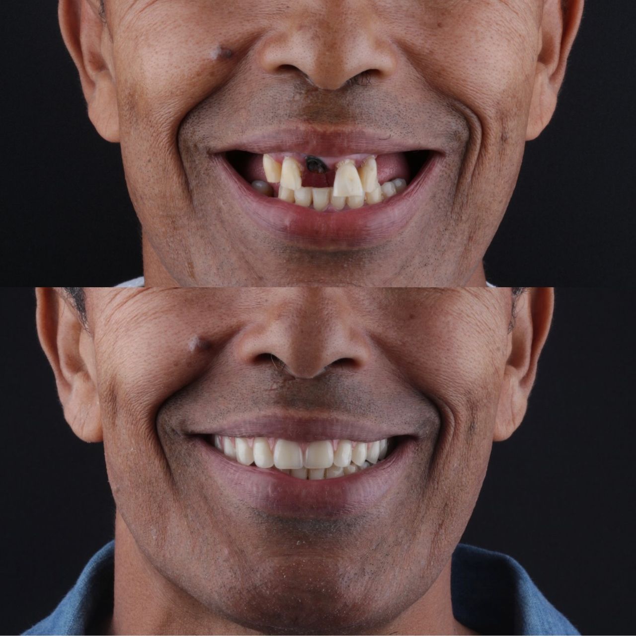 Guilherme  Carvalho-12