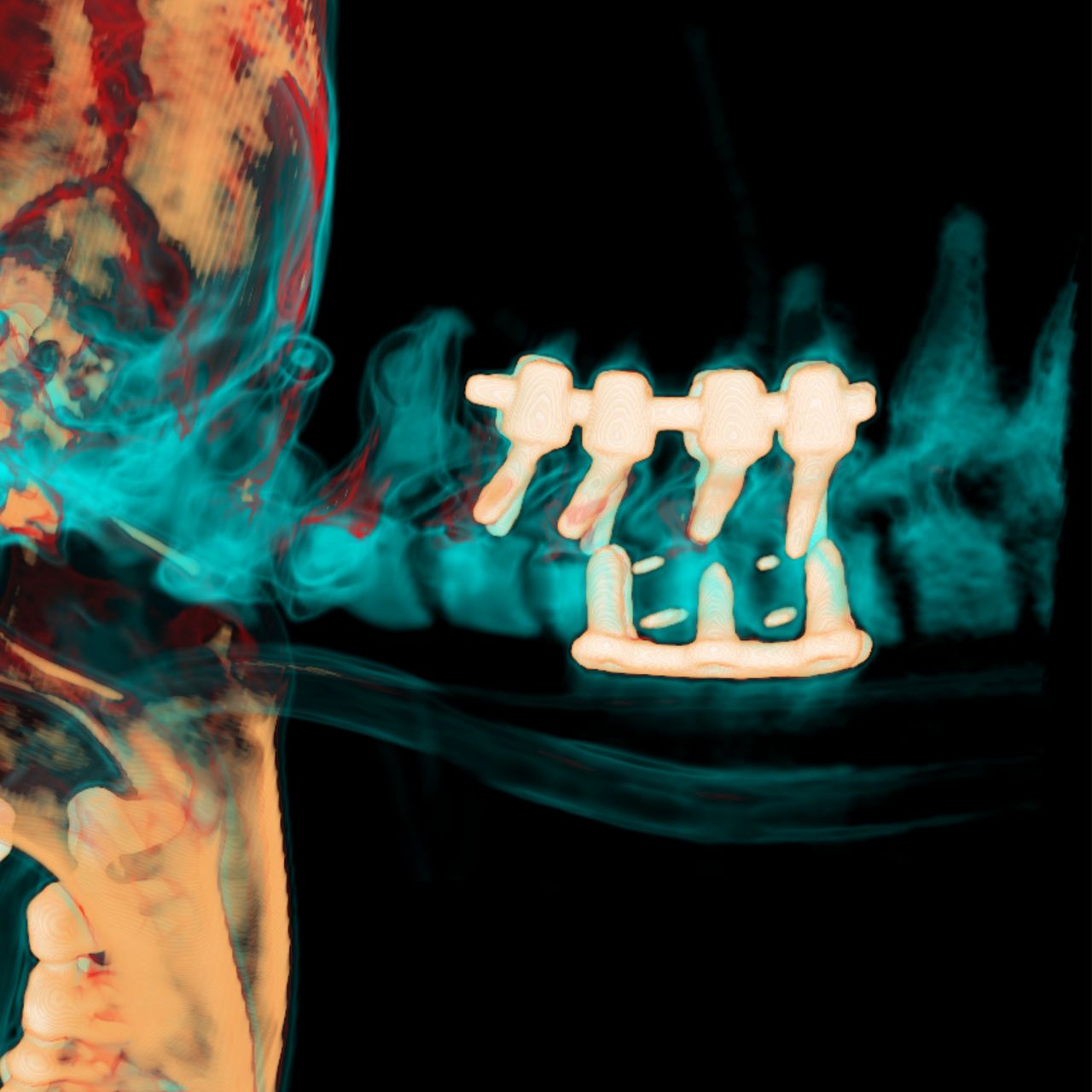 David Tafur Muñoz-1256