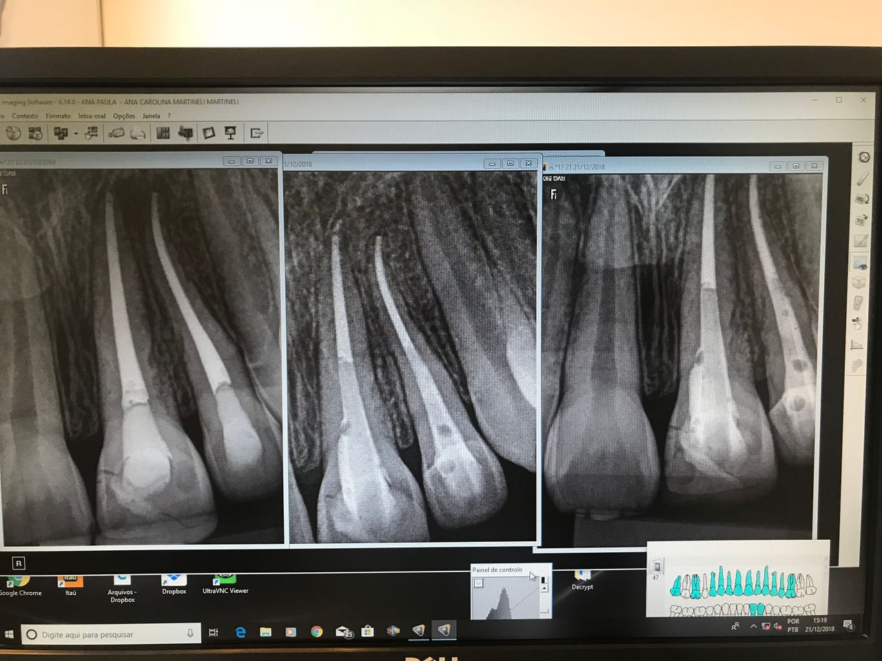 Ana Paula Minicheli Jose Martinelli-8