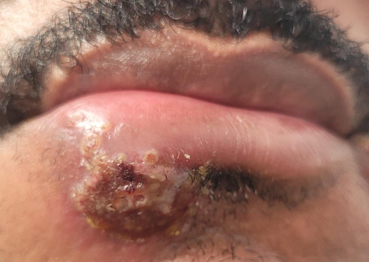 Francisco De Assis Almeida Lima Júnior-28