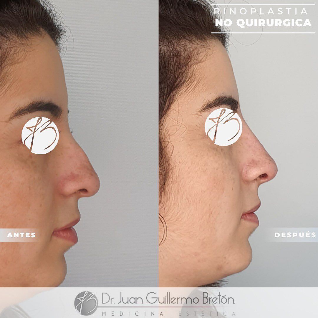 Juan Guillermo Bretón Franco-20