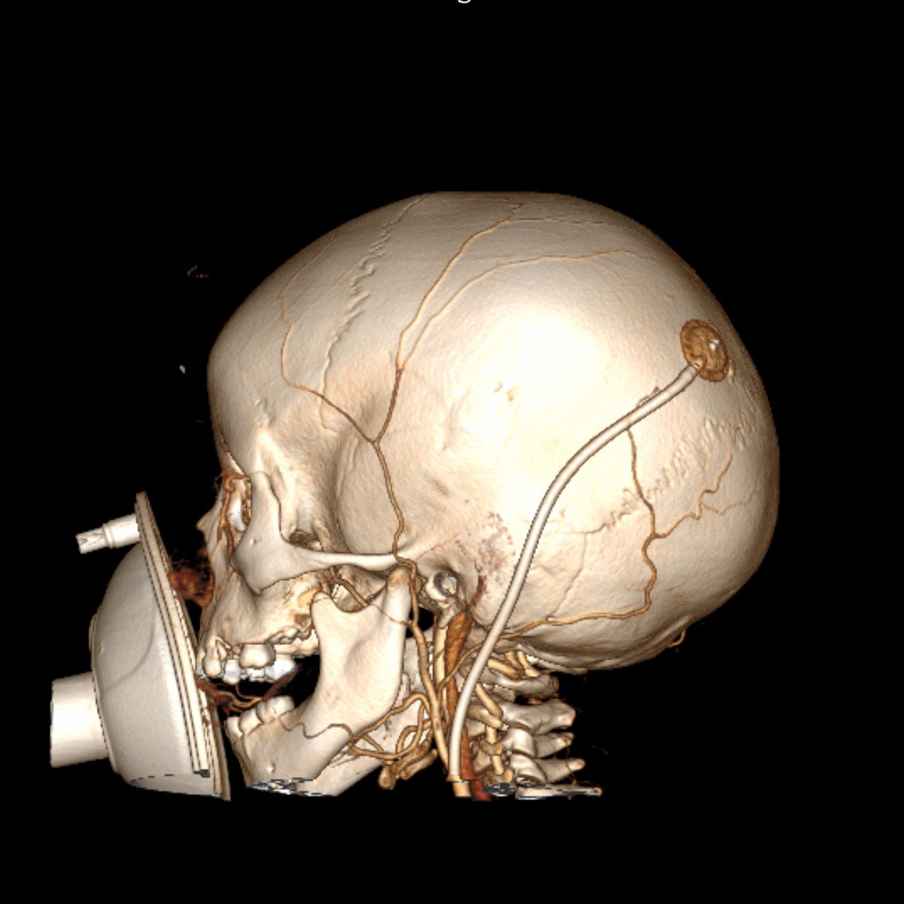 David Tafur Muñoz-1262