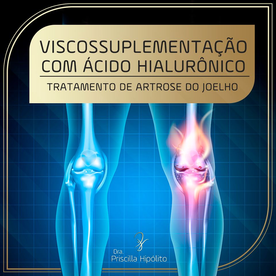 Priscilla Hipólito-7