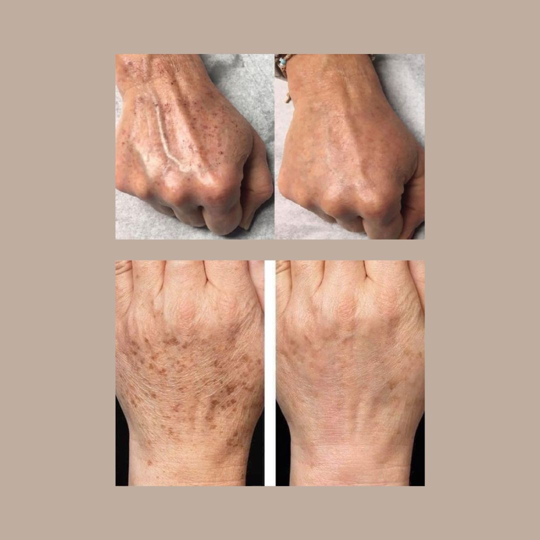 Mónica Hernandez Bulla-10