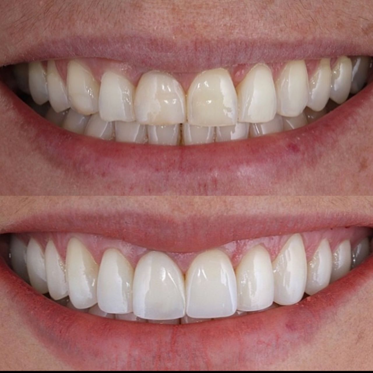 Ana Carolina Paschoalino-11