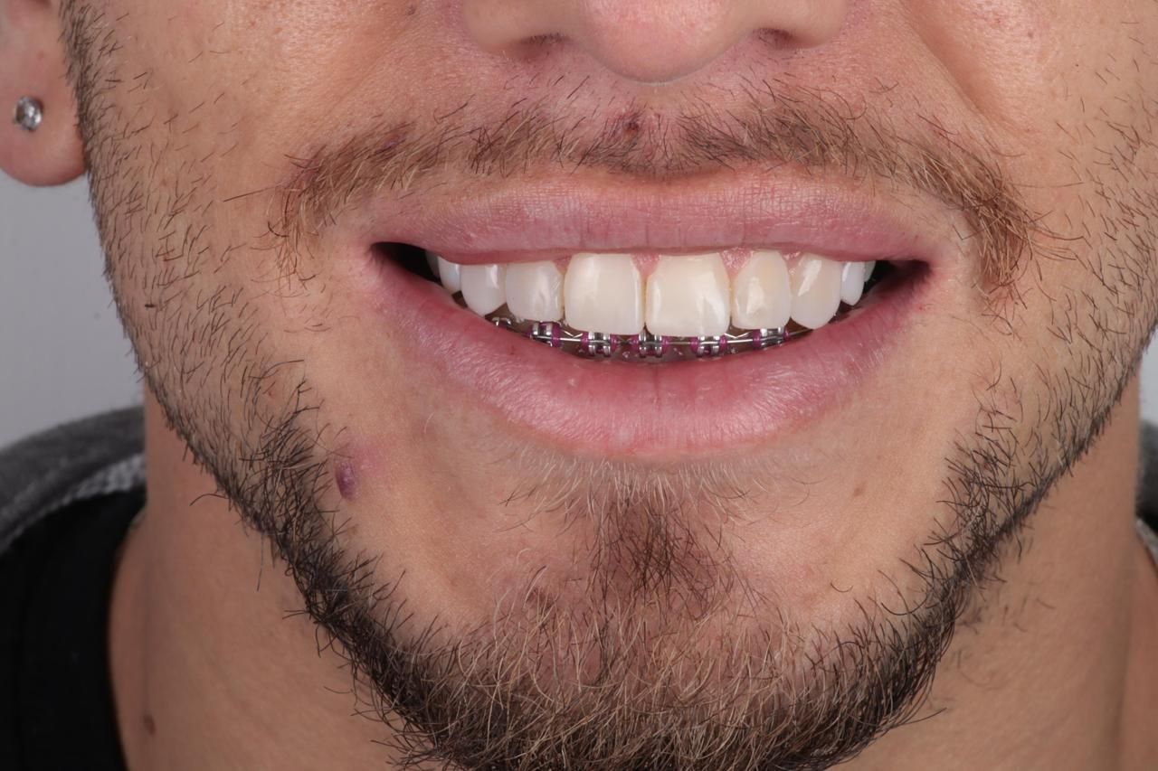 Miguel Angel Ovalle Rivera-2