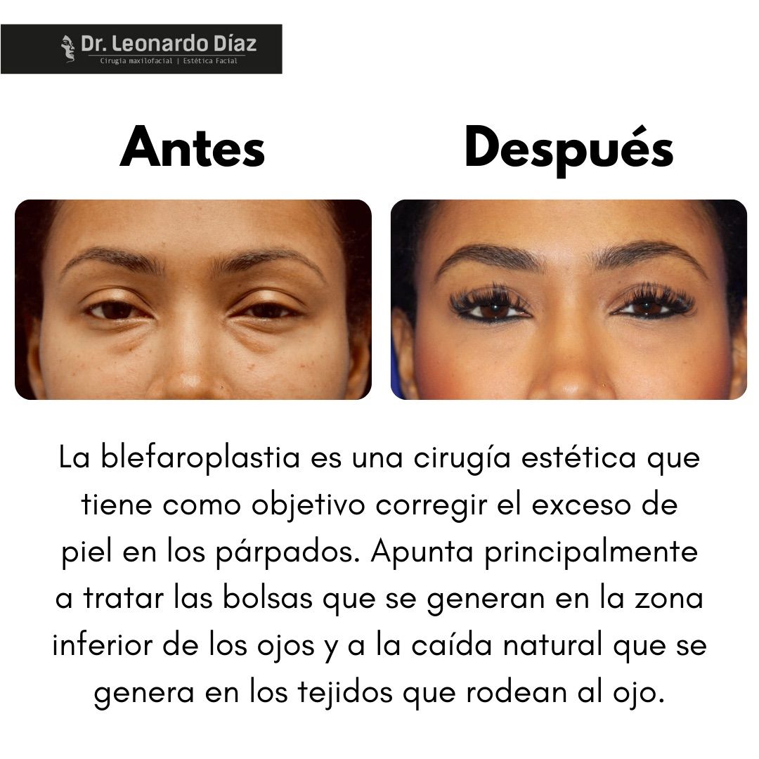 Leonardo Diaz Martínez-13