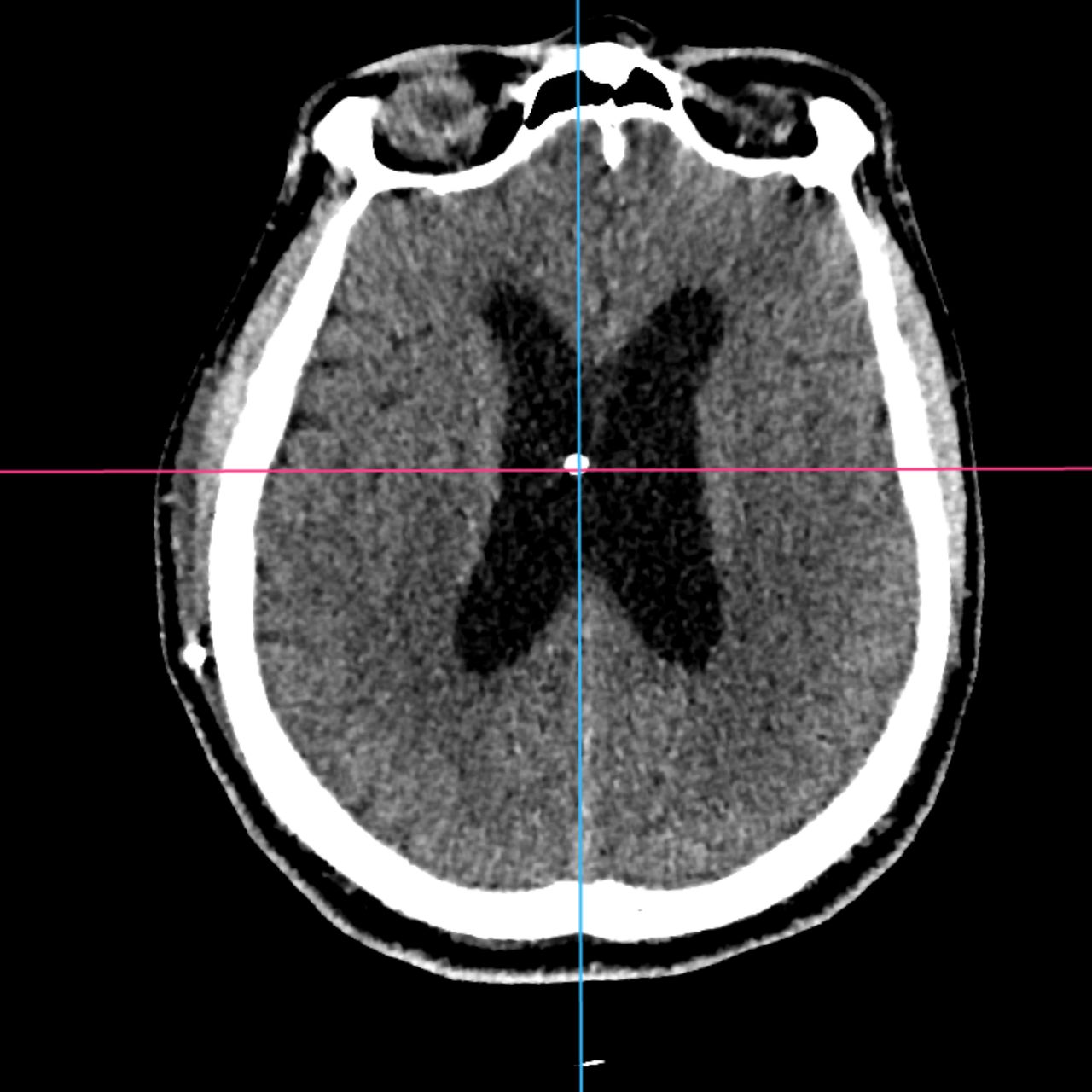 David Tafur Muñoz-2400