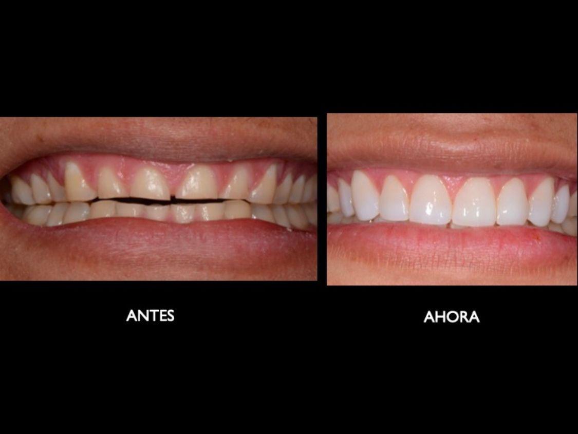 Melissa Vargas Castellanos-24