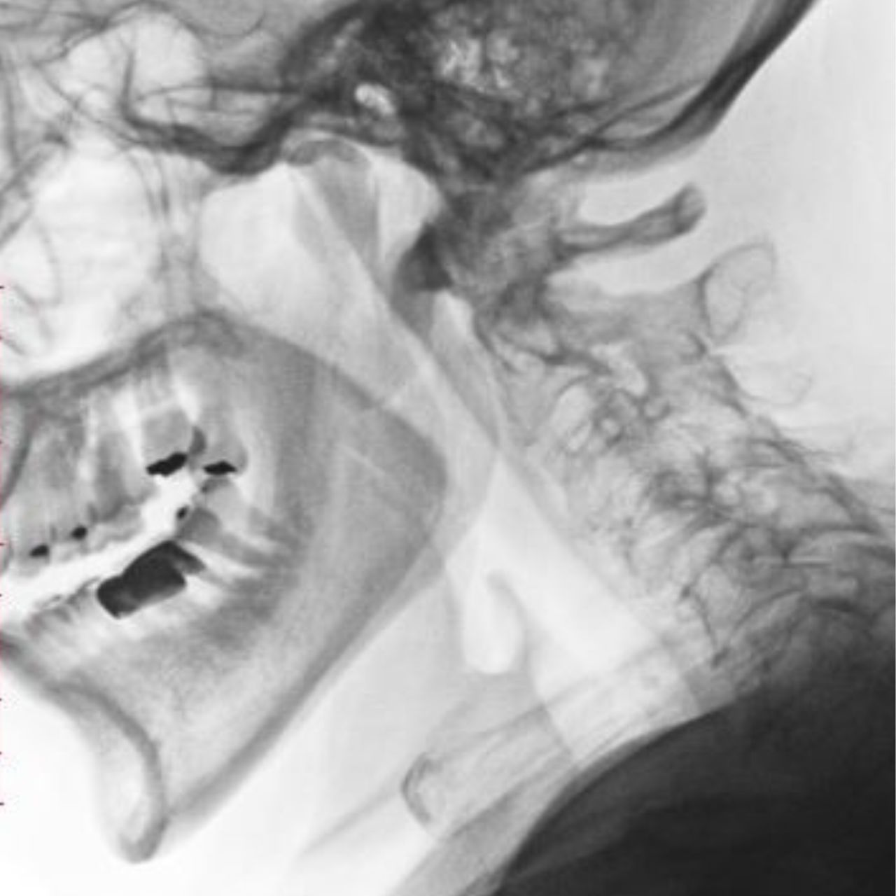 David Tafur Muñoz-1630