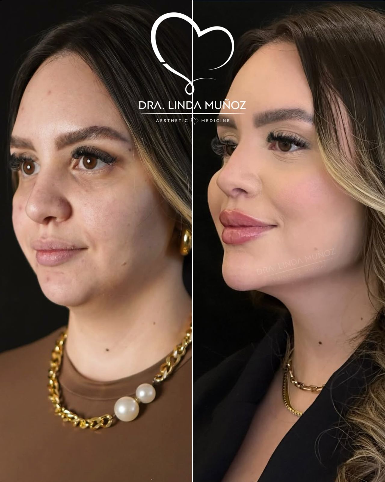 Linda Muñoz-29