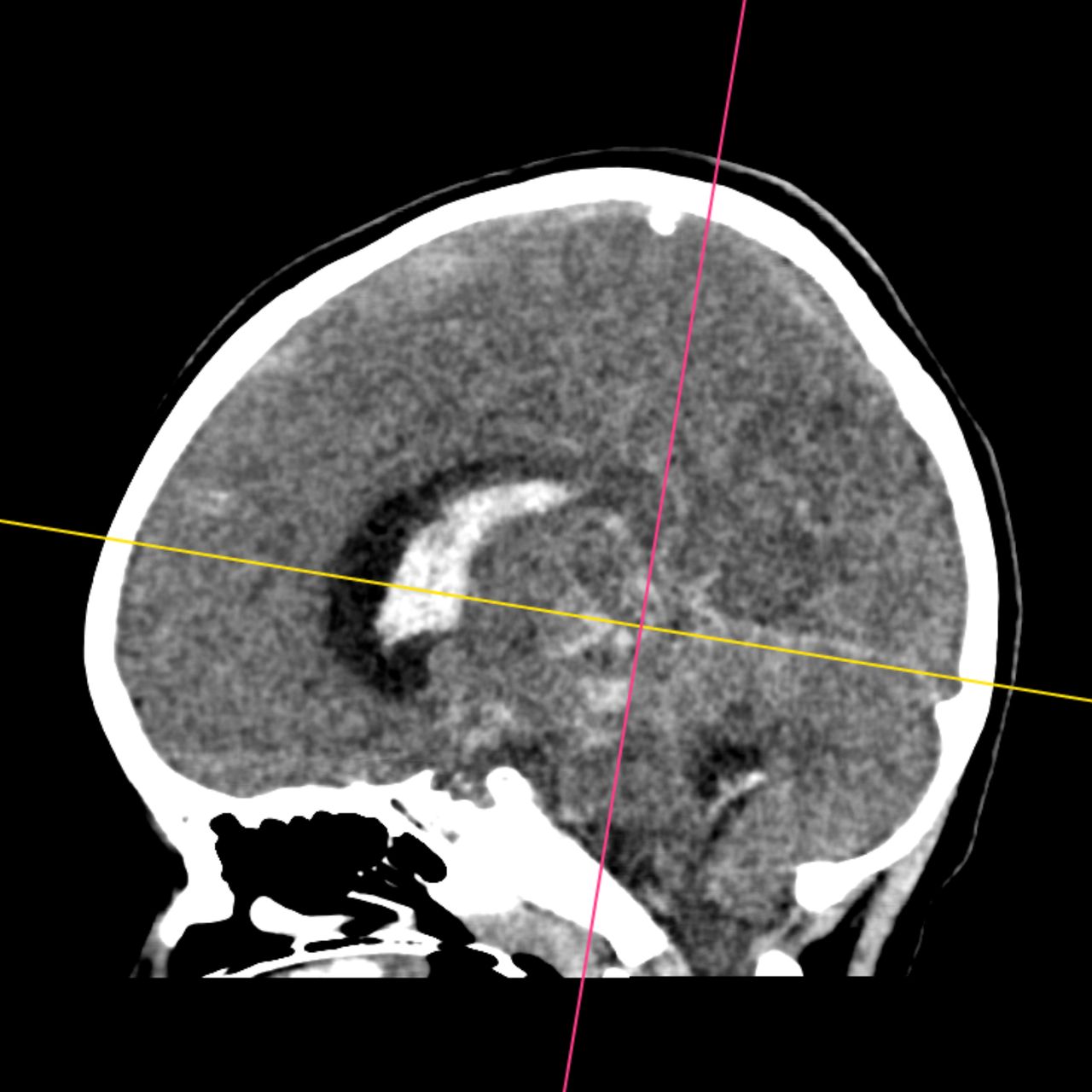 David Tafur Muñoz-1805