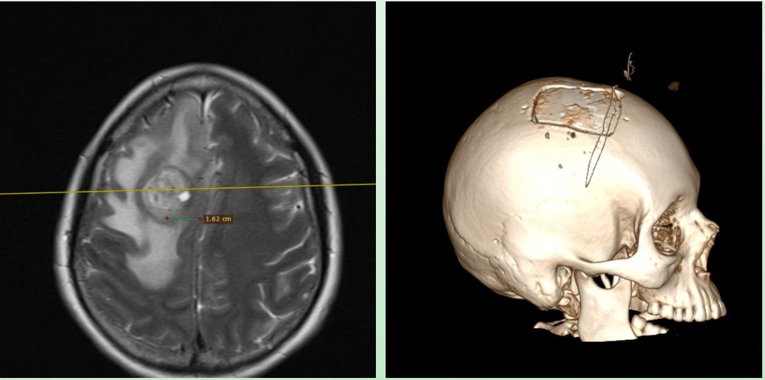 David Tafur Muñoz-2297