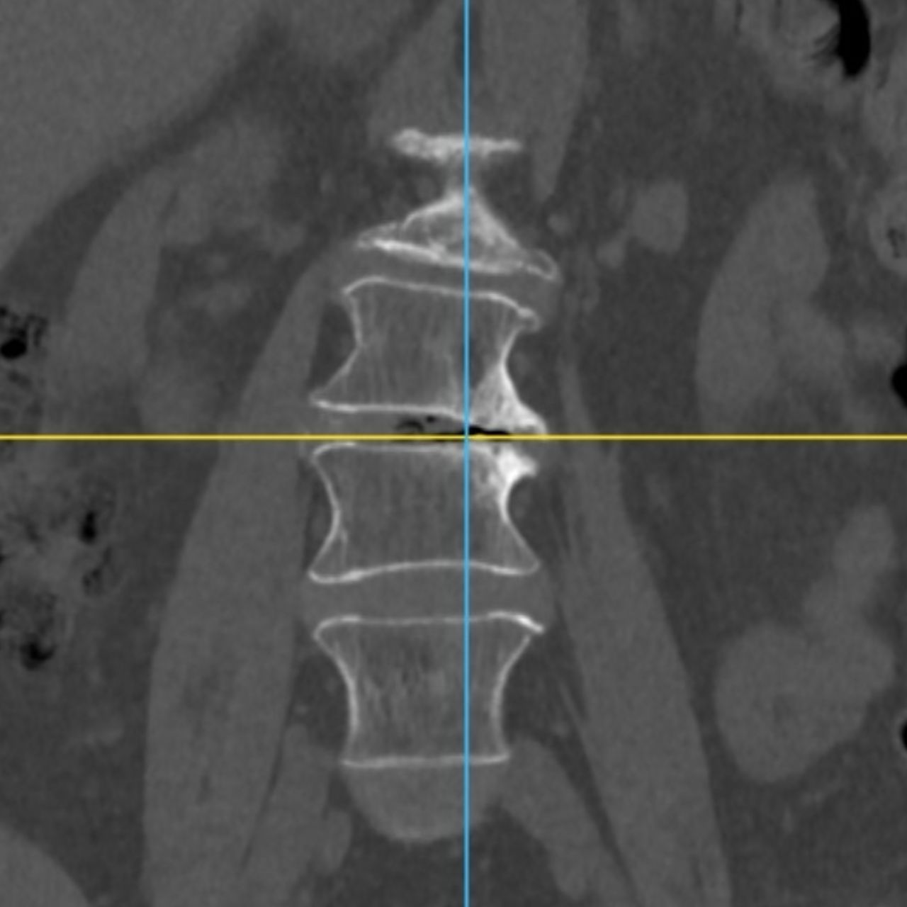 David Tafur Muñoz-1801