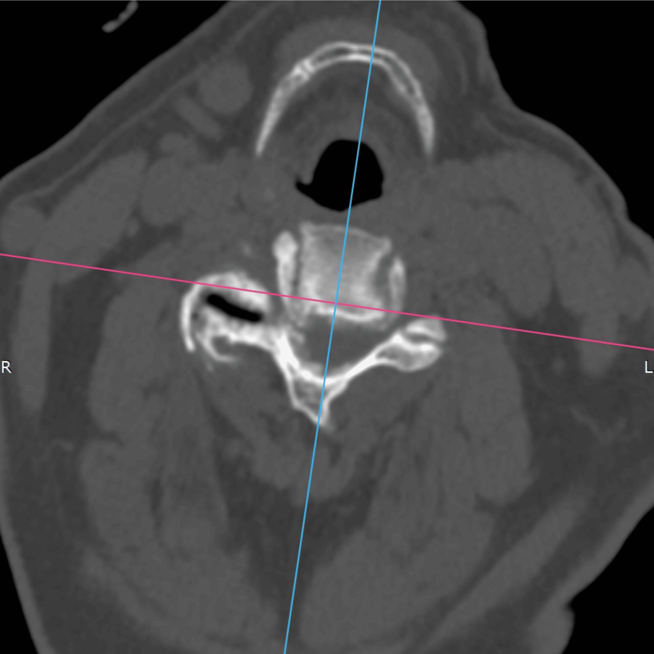 David Tafur Muñoz-2344