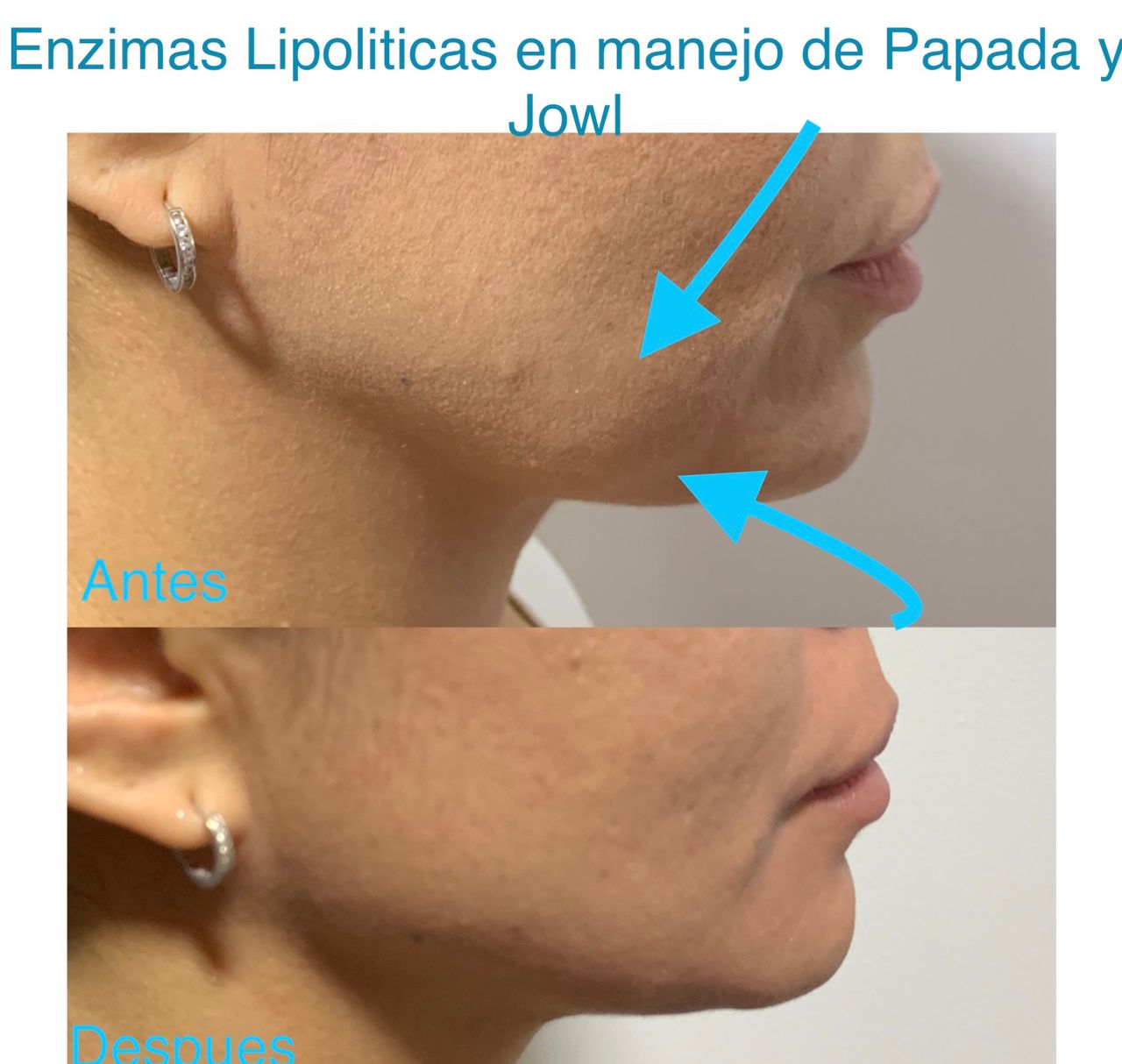 Maria Gisela Angel Losada-12