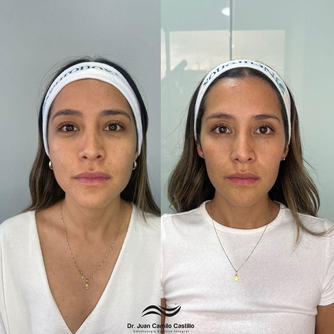 Juan Camilo Castillo-28