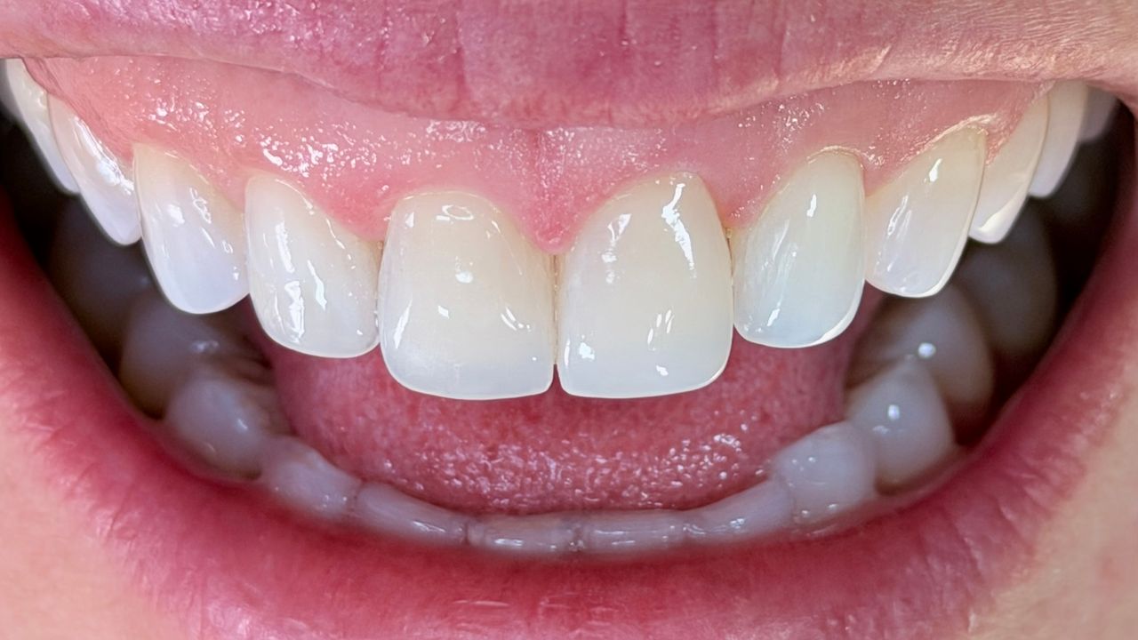 Melissa Vargas Castellanos-51