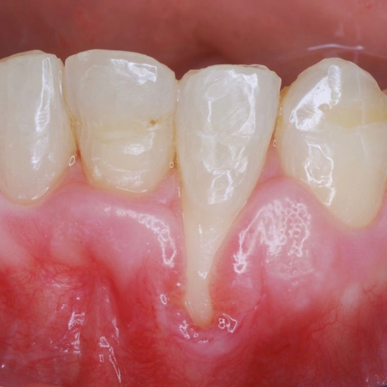 Ignacio Pezo Mundaca-6