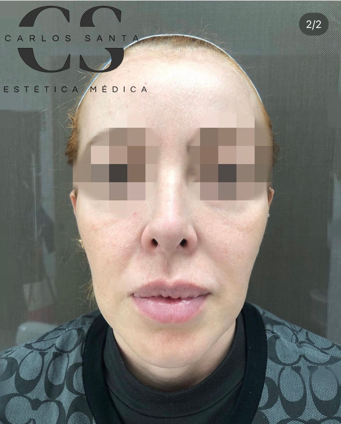 Carlos Andrés Santa-10