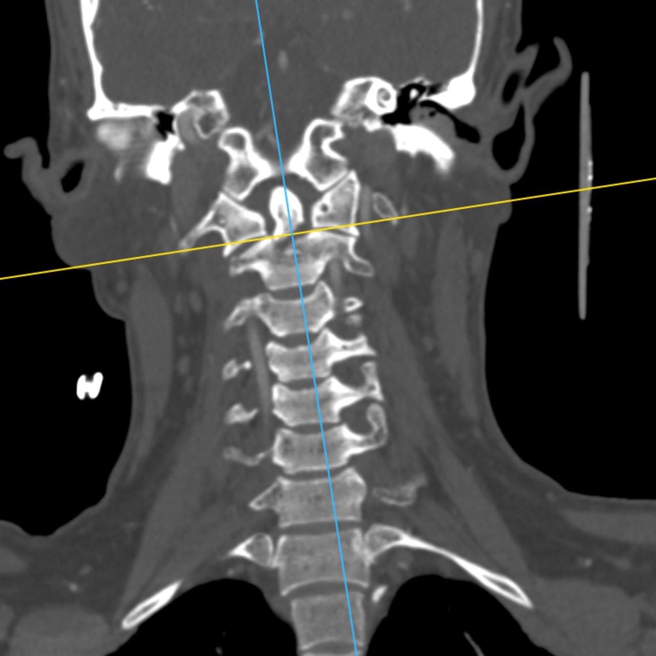 David Tafur Muñoz-1927