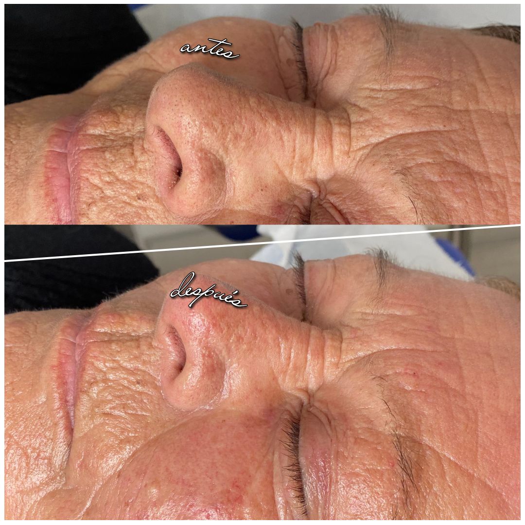 Scarlett Bartsch Ferrada-44