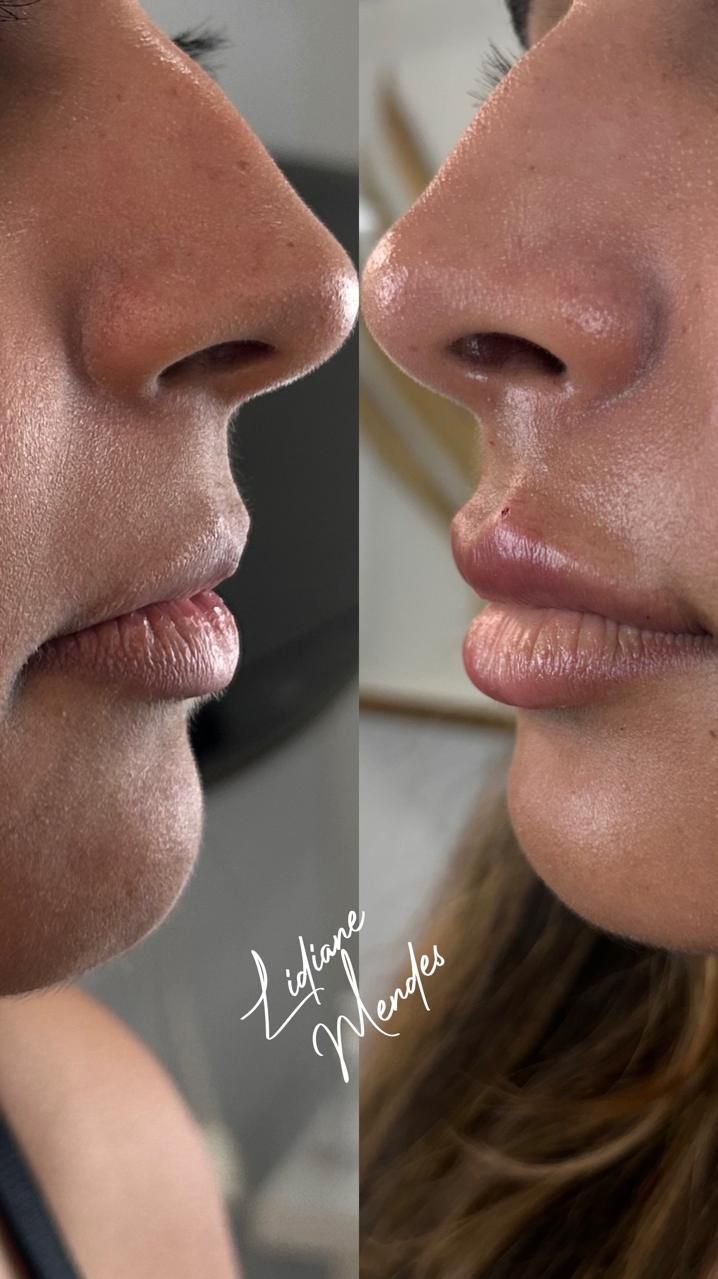 Lidiane Morais Mendes-36