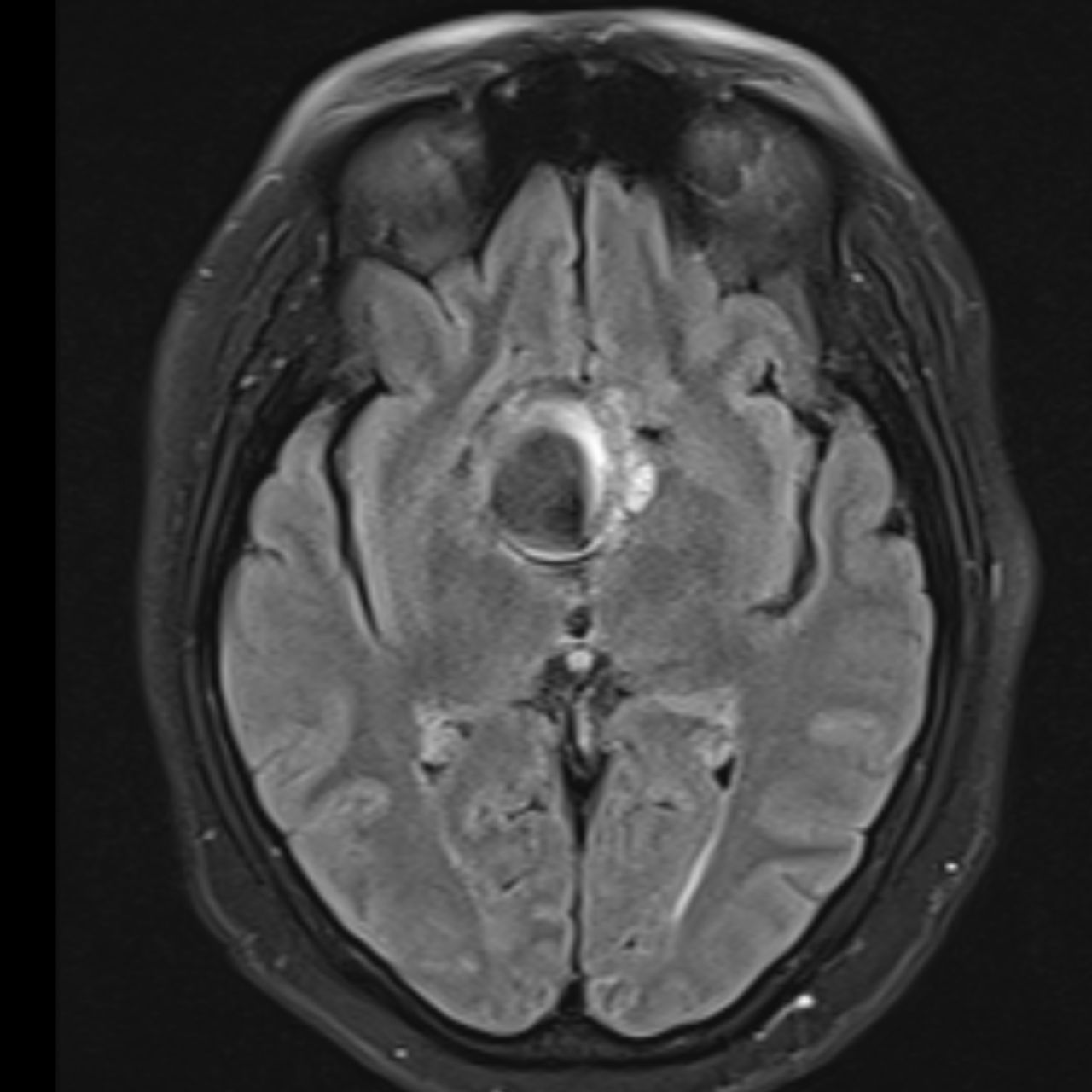 David Tafur Muñoz-1705