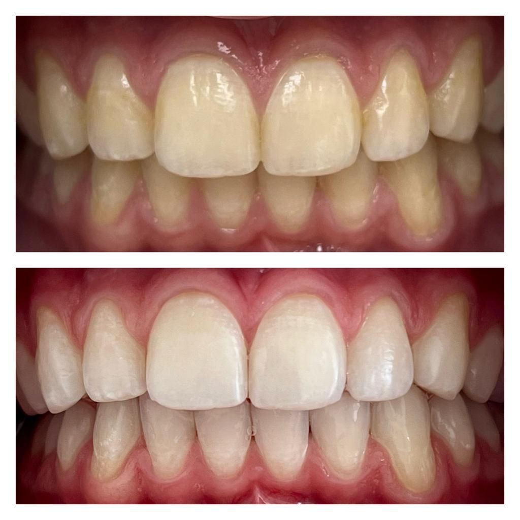 Adriana Souto Nôga .-1