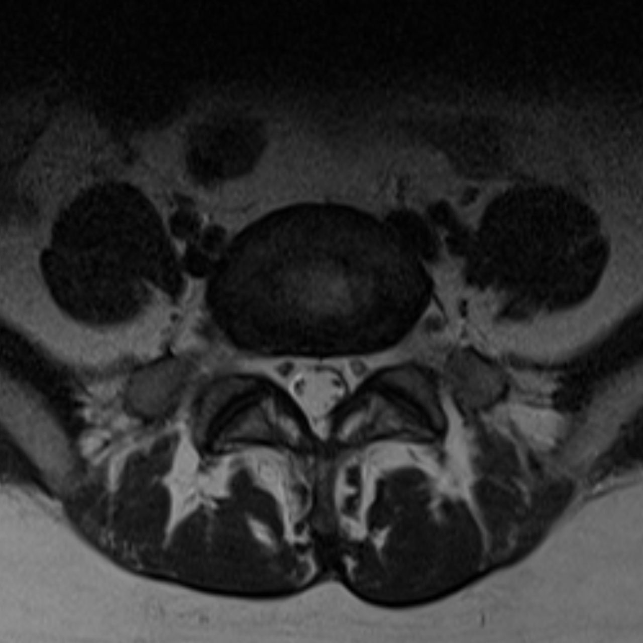 David Tafur Muñoz-2233