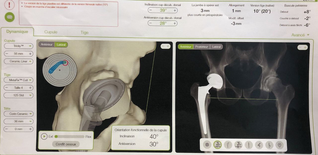Lucas Thudium-25