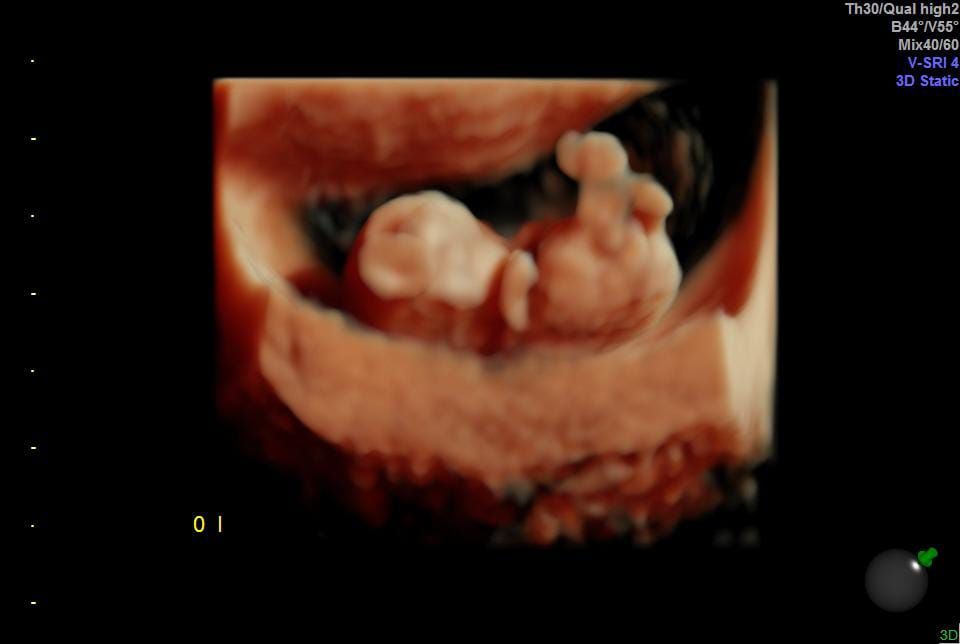 Cesar Vicente Albornoz Moreira-5