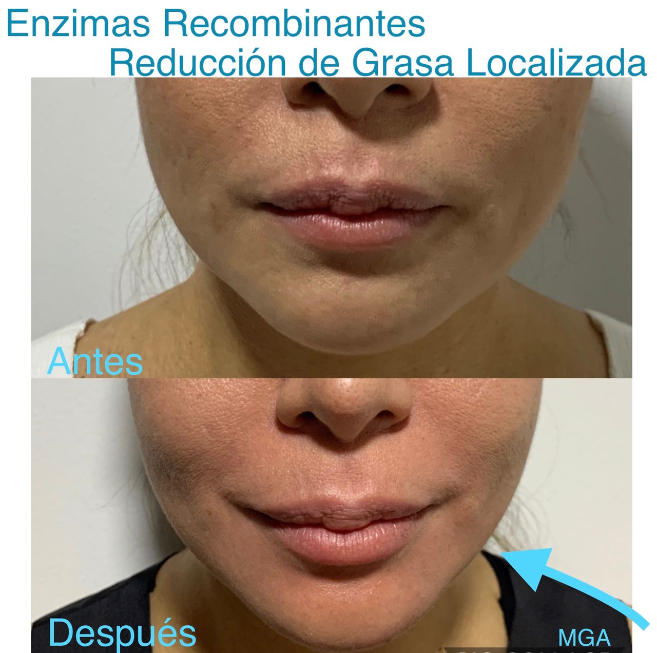 Maria Gisela Angel Losada-11