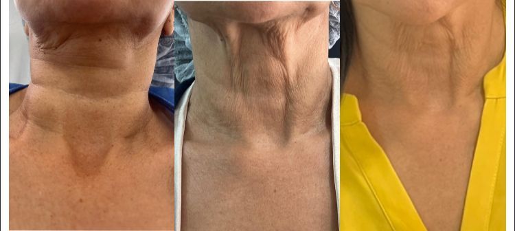 Santiago Muñoz Piñeros-4