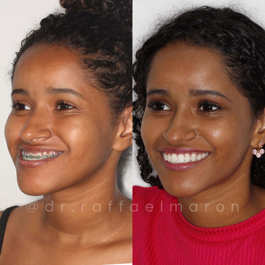 Raffael Maron Vieira De Noronha-10