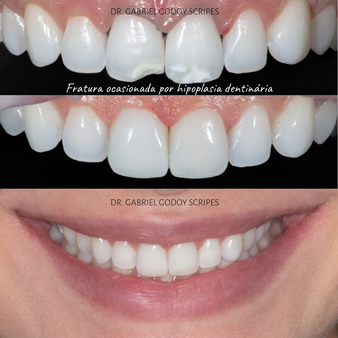 Gabriel Godoy Scripes-5