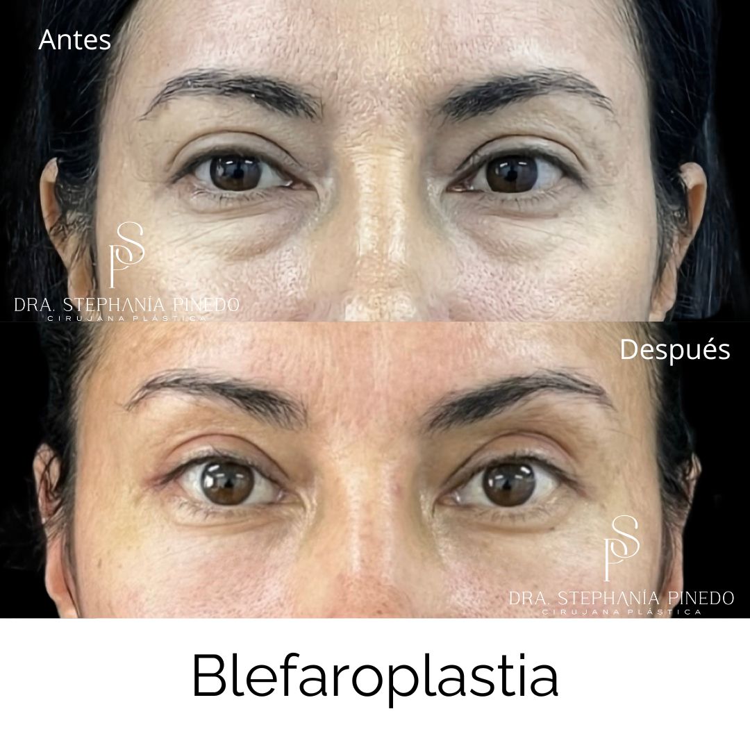 Stephanía Pinedo García-13