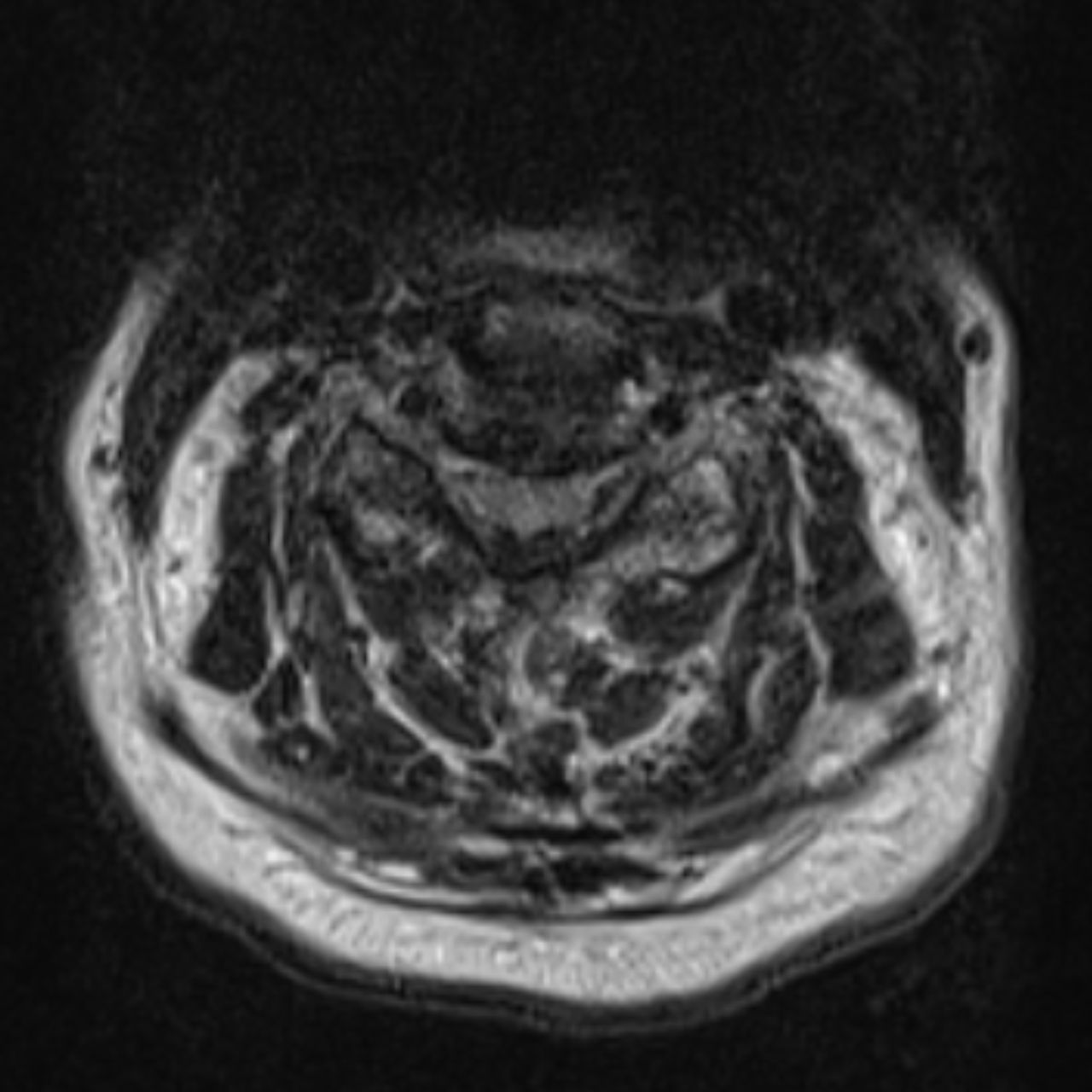 David Tafur Muñoz-1577