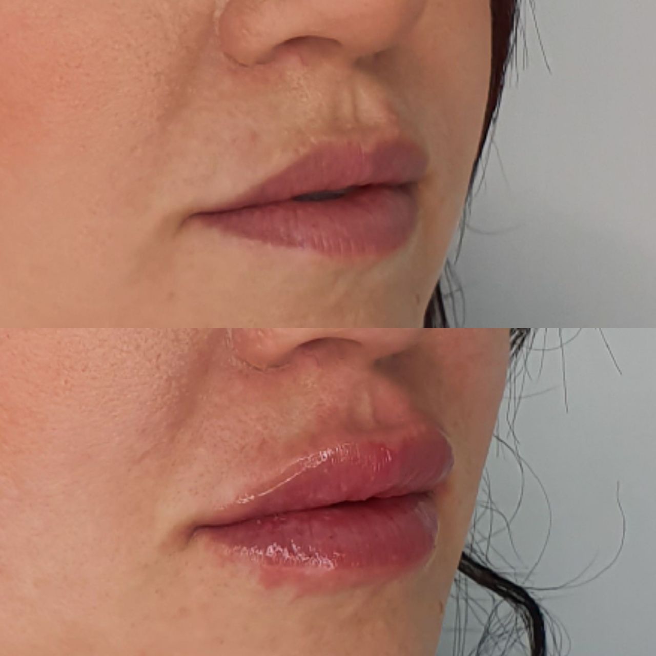 Juan Guillermo Bretón Franco-23