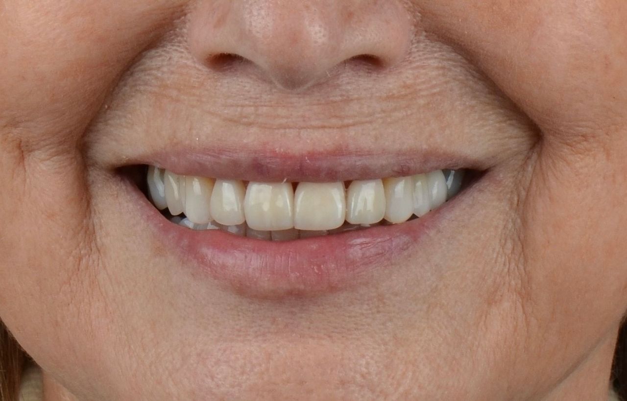 Luciano Varas Salinas-41