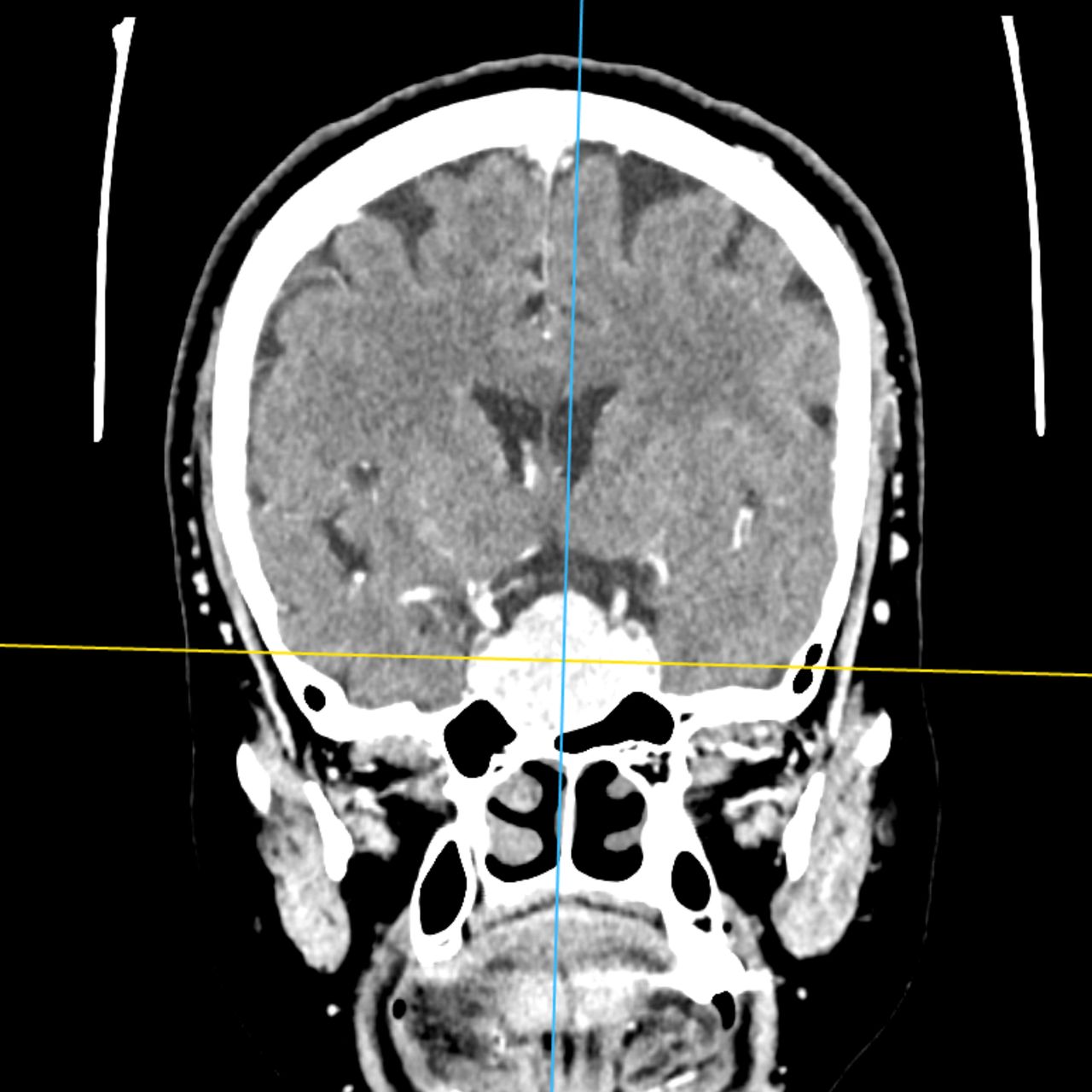 David Tafur Muñoz-1819