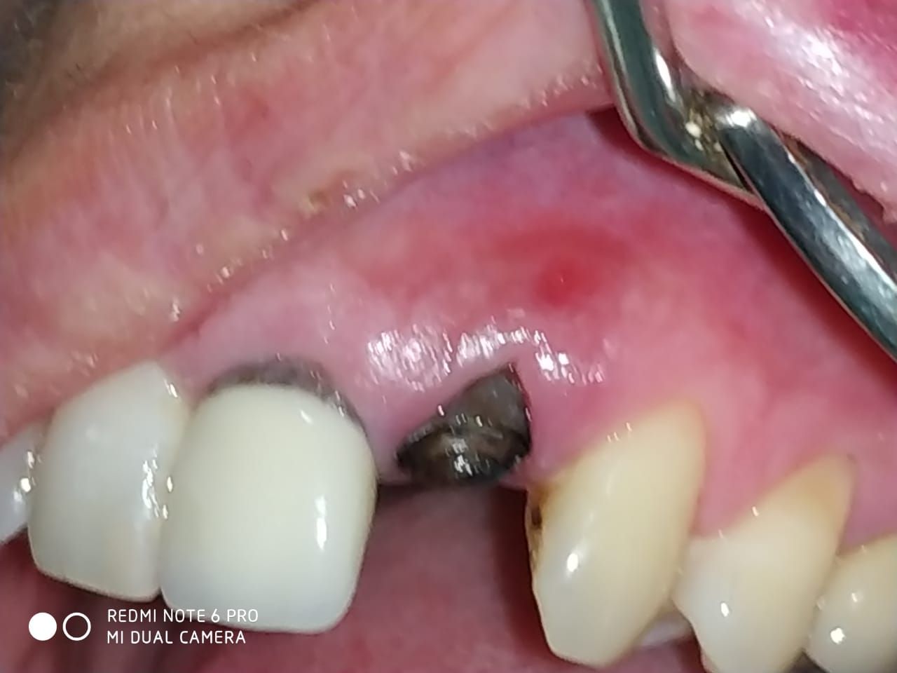 Pablo B. Azcárate-8