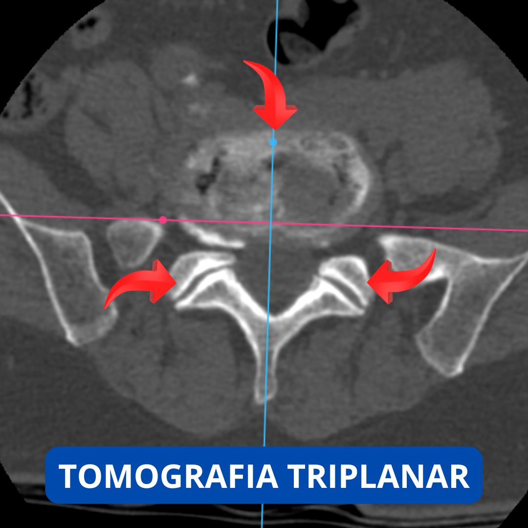 David Tafur Muñoz-2319