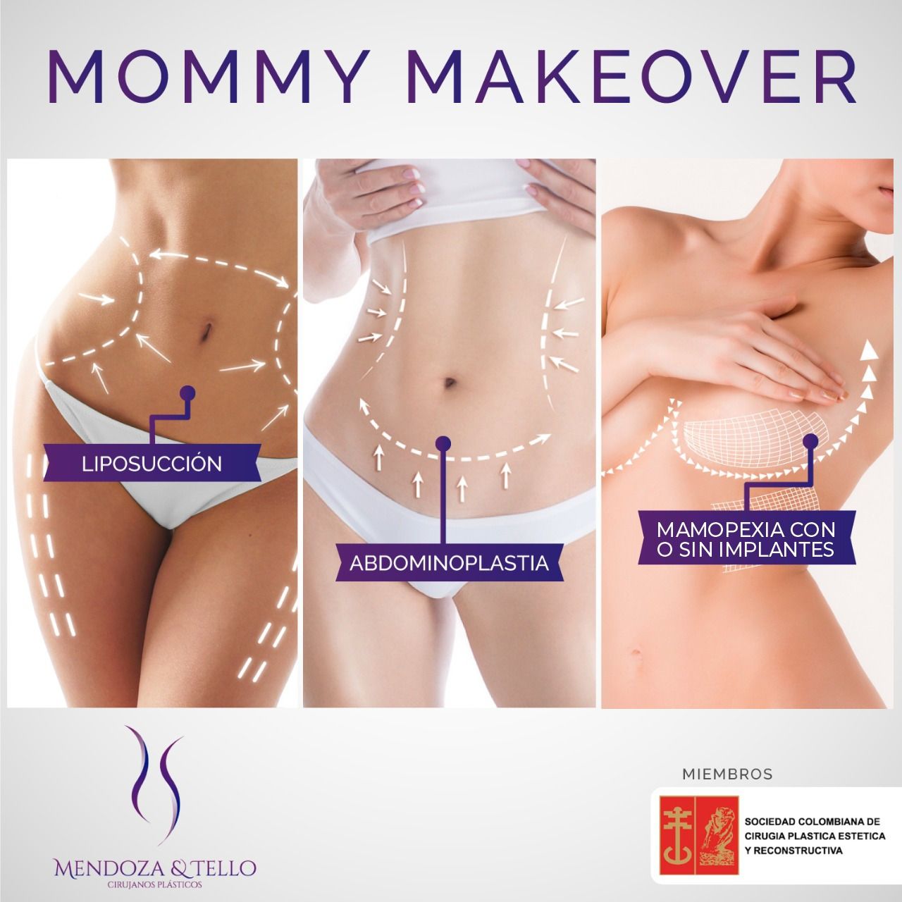 Alexander Mendoza-16