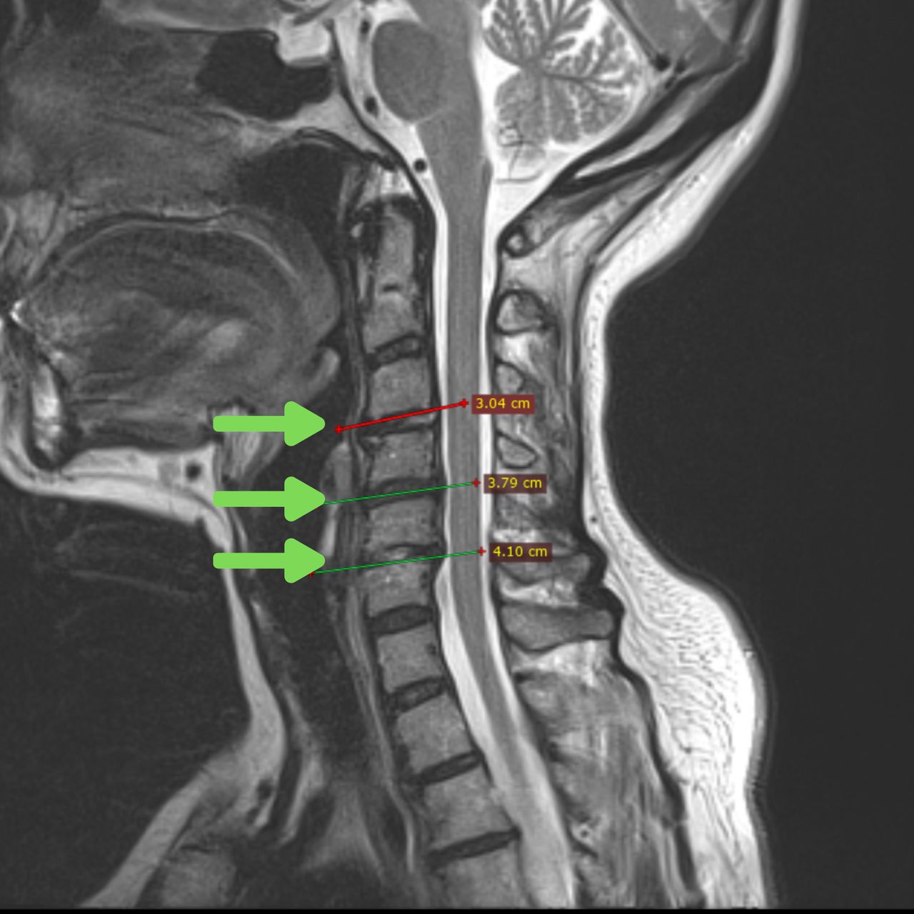 David Tafur Muñoz-2222