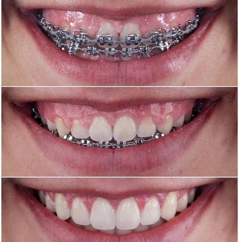 Ana Carolina Paschoalino-14