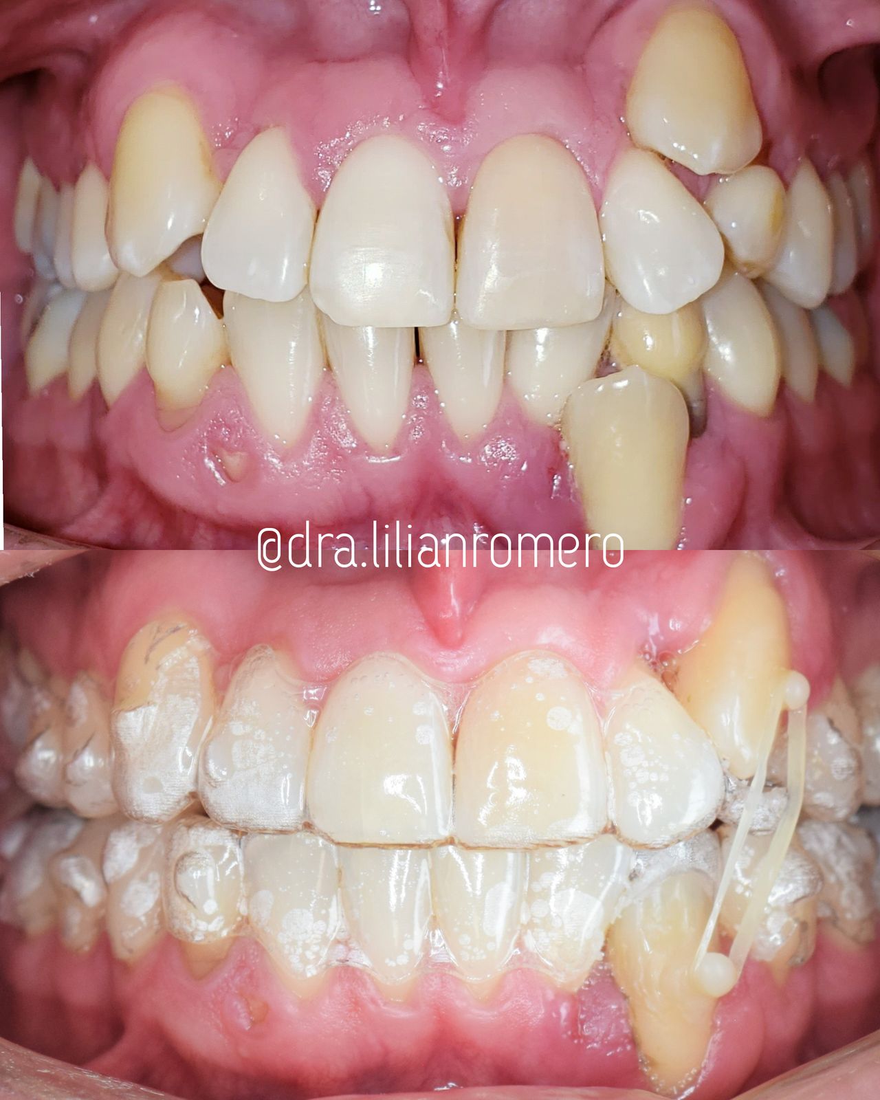 Lilian Catalina Romero Diaz-11